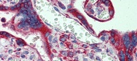 Anti-CYP11A1 Rabbit Polyclonal Antibody