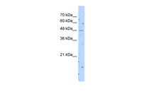 Anti-SLC22A23 Rabbit Polyclonal Antibody