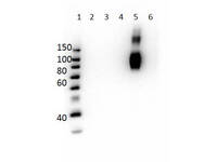 Anti-HbG Mouse Monoclonal Antibody [Clone: 4B3.B5.F3.B7]
