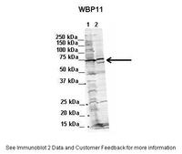 Anti-WBP11 Rabbit Polyclonal Antibody