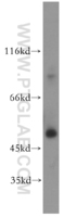 Anti-SIRT6 Rabbit Polyclonal Antibody
