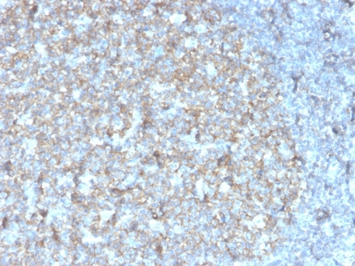 ANTIBODY ANTI-TAPA1 R13322 100UG