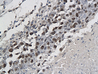Anti-TP53 Rabbit Polyclonal Antibody