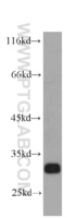 Anti-STX6 Mouse Monoclonal Antibody [clone: 2B6G4]