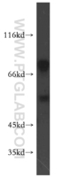Anti-PSMD12 Rabbit Polyclonal Antibody