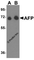 Anti-AFP Rabbit Polyclonal Antibody