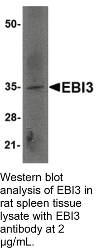 Antibody EBI3 0.1MG