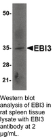 Anti-EBI3 Rabbit Polyclonal Antibody