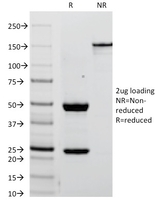 Anti-Placental Alkaline Phosphatase Mouse Monoclonal Antibody [clone: ALPP/238]
