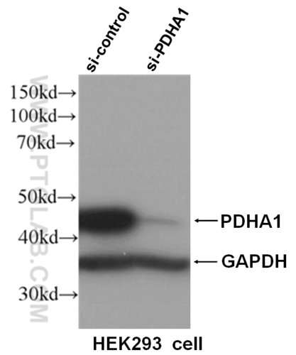 Anti-PDHA1(Polyclonal)