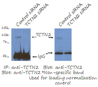 Anti-TCTN2 Rabbit Polyclonal Antibody