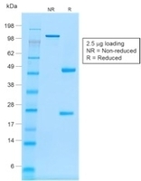 Anti-CD20 Mouse Recombinant Antibody [clone: rIGEL/773]