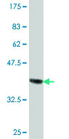 Anti-CDG1C Mouse Polyclonal Antibody