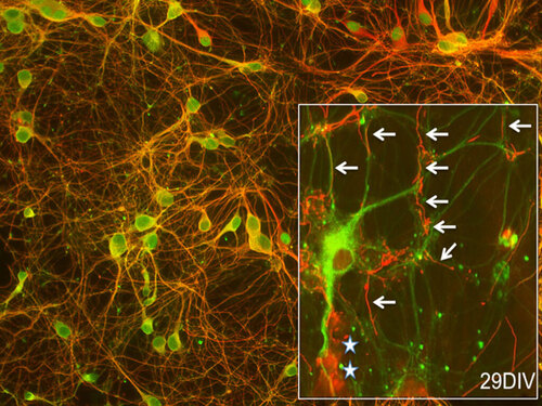 R-Cx - Rat Brain Cortex Neurons, Cryopreserved, in PNGM* BulletKit, =4 million cells/vial
