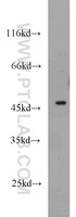 Anti-GATA3 Rabbit Polyclonal Antibody