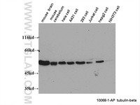 Anti-TUBB Rabbit Polyclonal Antibody