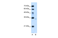 Anti-PPAP2A Rabbit Polyclonal Antibody