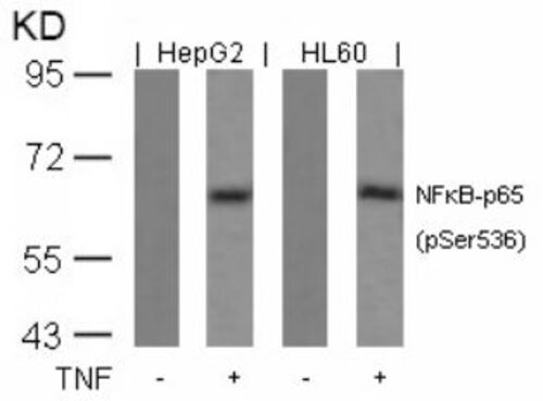 NFkB p65 (phospho Ser536) Antibody