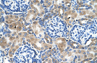 Anti-SOD1 Rabbit Polyclonal Antibody