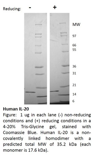 Human Recombinant IL-20 (from <i>E. coli</i>)