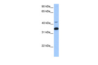 Anti-GNB2 Rabbit Polyclonal Antibody