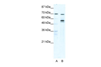 Anti-DDX55 Rabbit Polyclonal Antibody