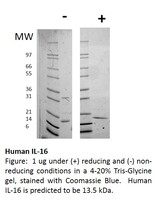 Human Recombinant IL-16 (from E. coli)