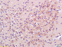 Anti-CDH13 Rabbit Polyclonal Antibody