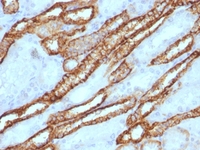 Anti-Cadherin 16 Rabbit Polyclonal Antibody