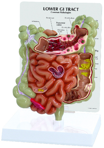Model colon and gi tract, size: 6x2-1/2x7-3/4IN, Card: 6-1/4x8-1/4IN, Base:6-1/2x5inch