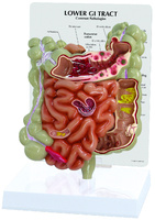 GPI Anatomicals® Gi Tact Model