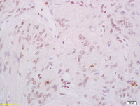 Anti-PRKDC Rabbit Polyclonal Antibody