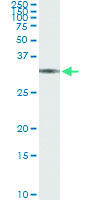 Anti-BRMS1 Antibody Pair