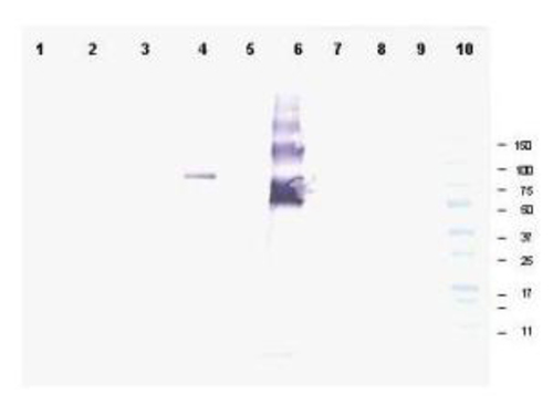 Ankrd26 [Rb] Antibody