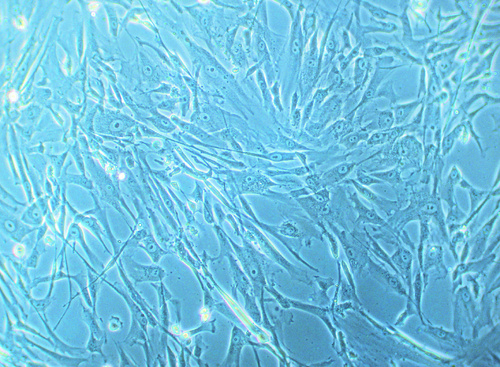 Human Umbilical Artery Smooth Muscle Cells (HUASMC), PromoCell