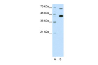 Anti-ZBTB33 Rabbit Polyclonal Antibody