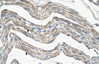 Anti-IDH3A Rabbit Polyclonal Antibody