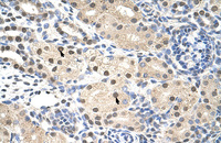 Anti-RNF14 Rabbit Polyclonal Antibody