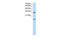 Anti-HNRNPUL1 Rabbit Polyclonal Antibody