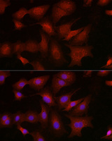 Anti-BMPR1B Rabbit Polyclonal Antibody