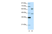 Anti-RFX4 Rabbit Polyclonal Antibody