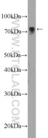 Anti-LIMK2 Rabbit Polyclonal Antibody