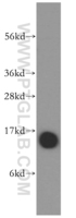 Anti-PFN1 Rabbit Polyclonal Antibody