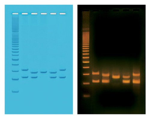 PCR VNTR HUMAN DNA TYPING KIT