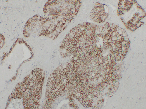 Anti-Cadherin 16 Mouse Monoclonal Antibody [clone: ABT-CDH16]