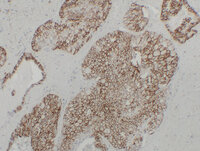Anti-Cadherin 16 Mouse Monoclonal Antibody [clone: ABT-CDH16]