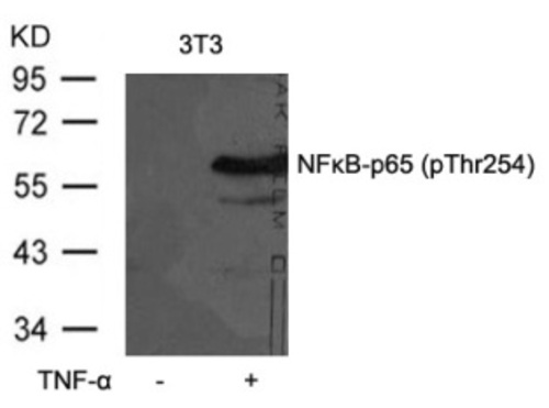 NFkB p65 (phospho Thr254) Antibody
