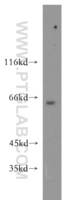 Anti-CDC2L6 Rabbit Polyclonal Antibody