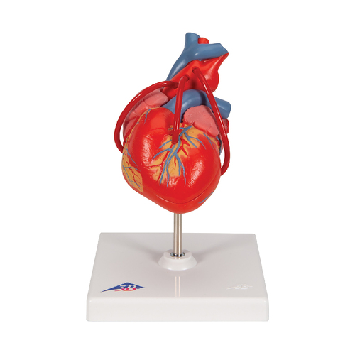 3B Scientific® Heart With Bypass Models