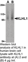 Anti-KLHL1 Rabbit Polyclonal Antibody